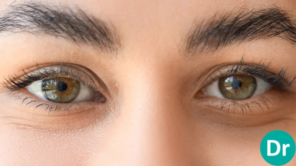 Dark Circles Treatment
