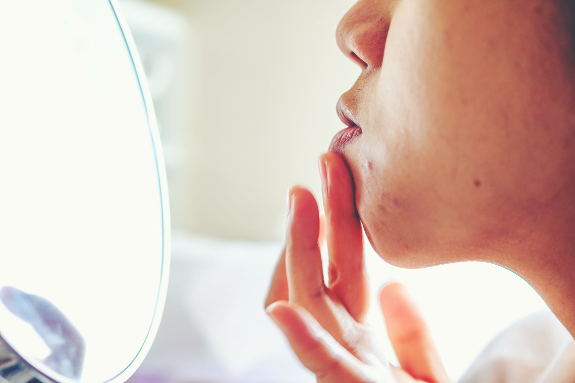 Acne 101: Different Types of Acne Explained