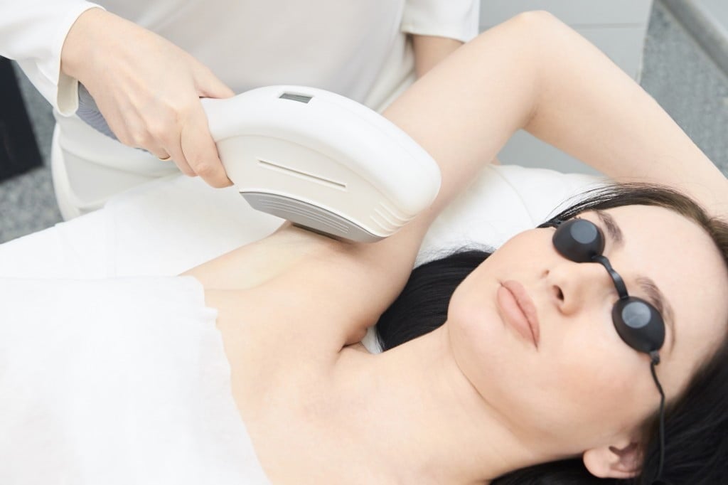 best hair removal