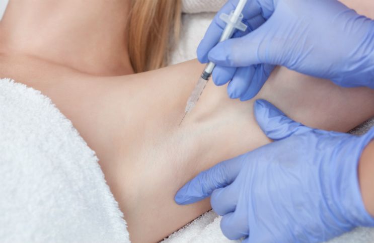 Botox for Excessive Under Arm Sweating