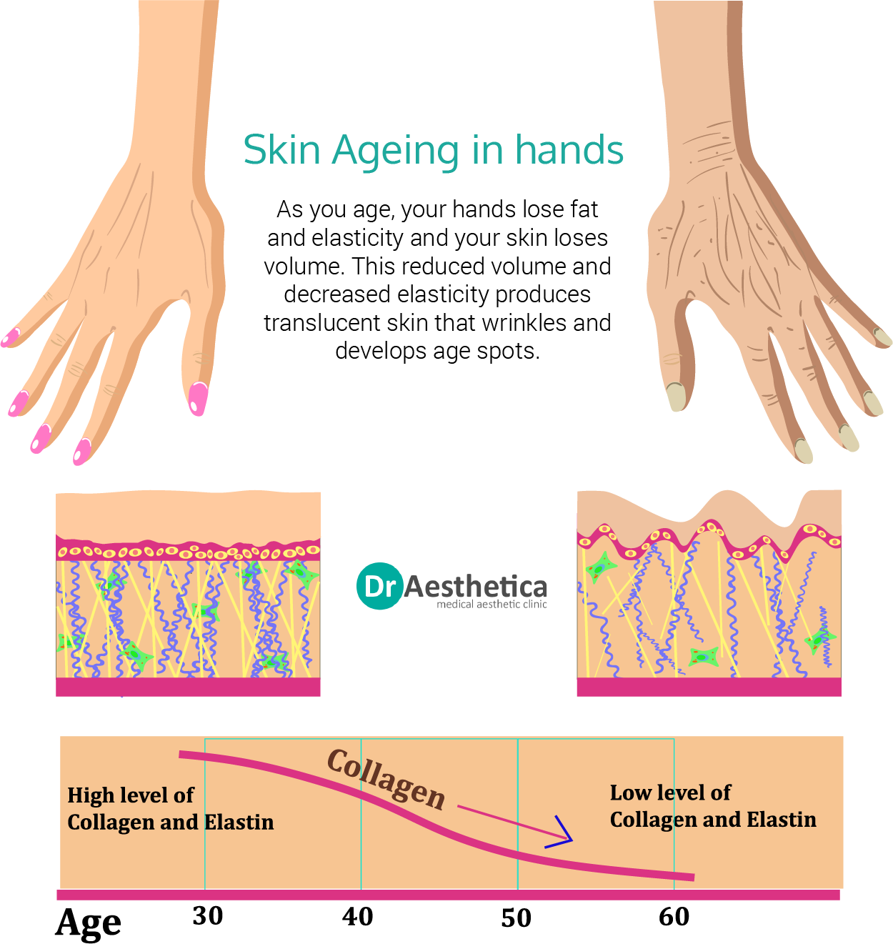 diagram of how skin ages in hands