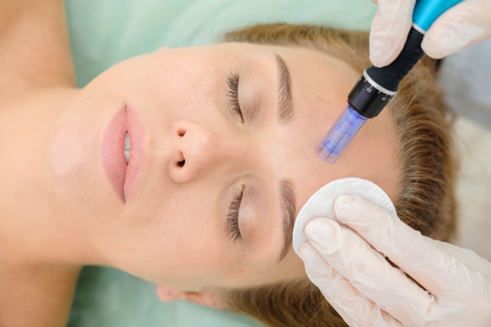 Skin Care Tips For Microneedling Aftercare