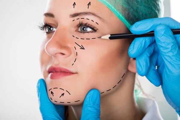 surgical facelift