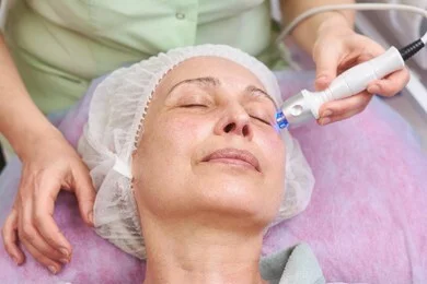 radio-frequency-skin-tightening-in-your-fifties
