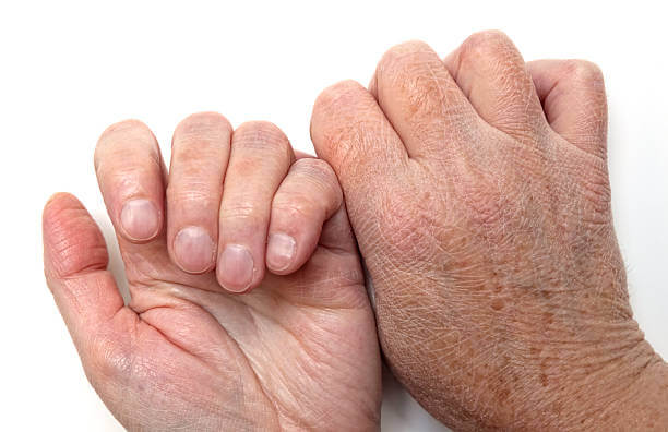 Why Your Hands Are Ageing Prematurely and What You Can Do About It