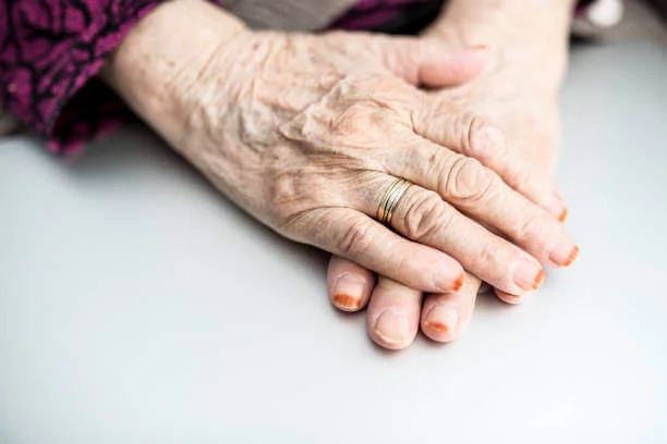 why-hands-ageing-prematurely