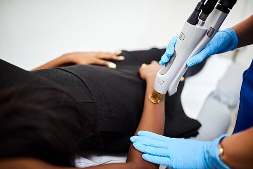 laser-hair-removal-dark-skin-tone