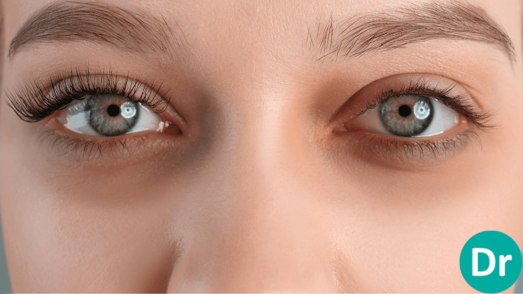 Can dark circles be reversed