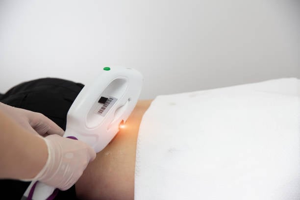 Intense-Pulsed-Light-not-working