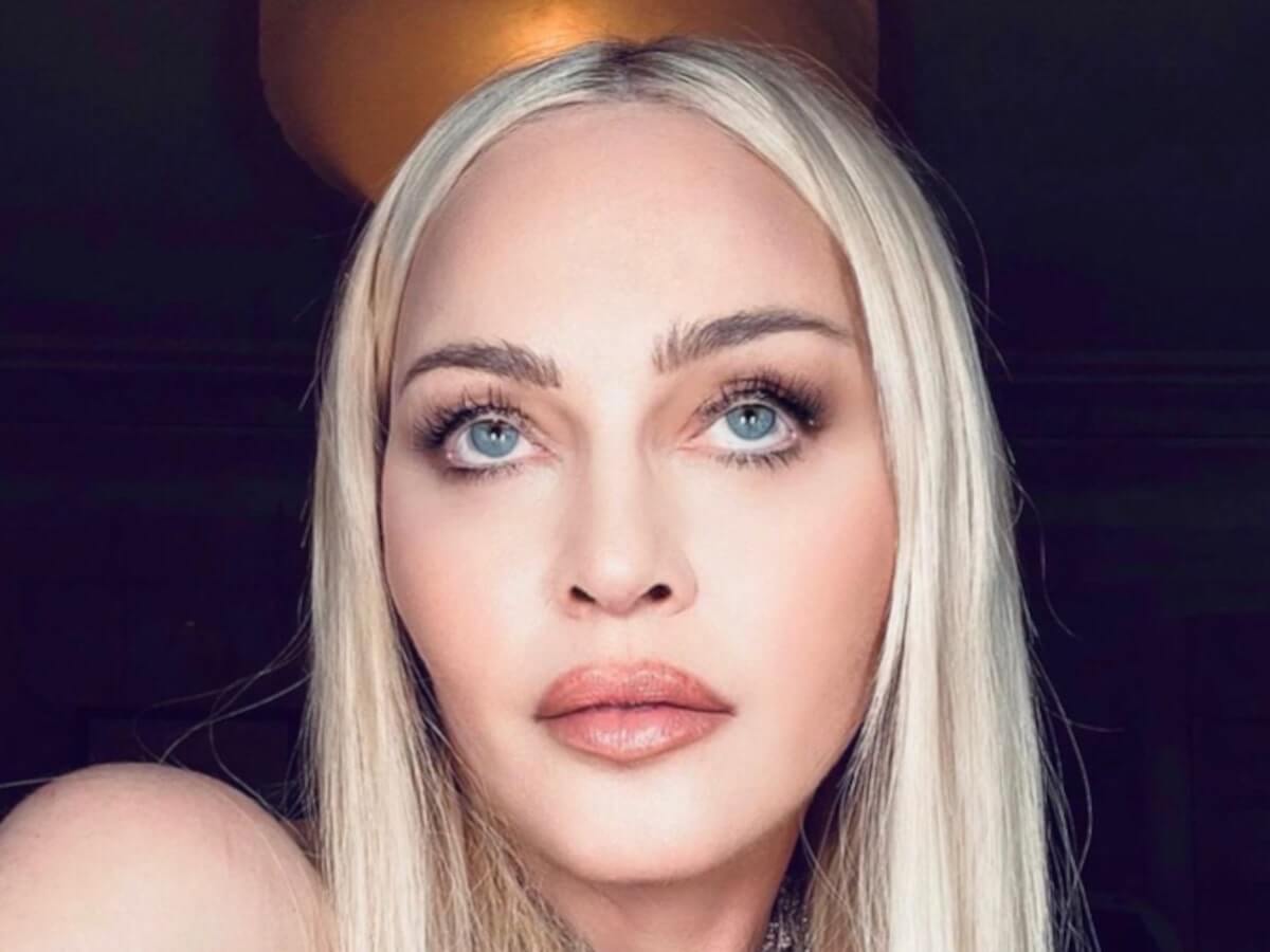 Frozen vs Natural Looking: Which Outcome Do You Want From Botox?