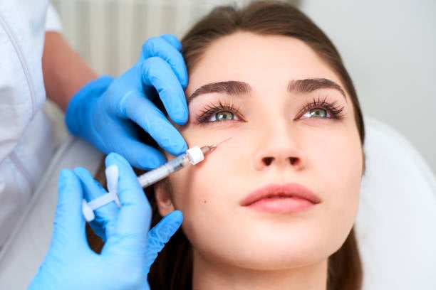 dermal filler results