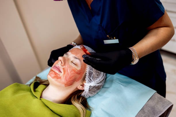 Skinpen microneedling