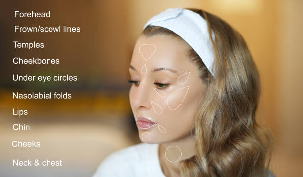 hyaluronic acid areas