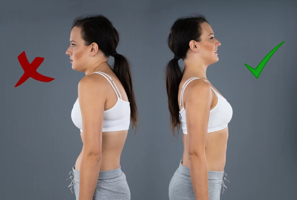 image of poor posture vs correct posture