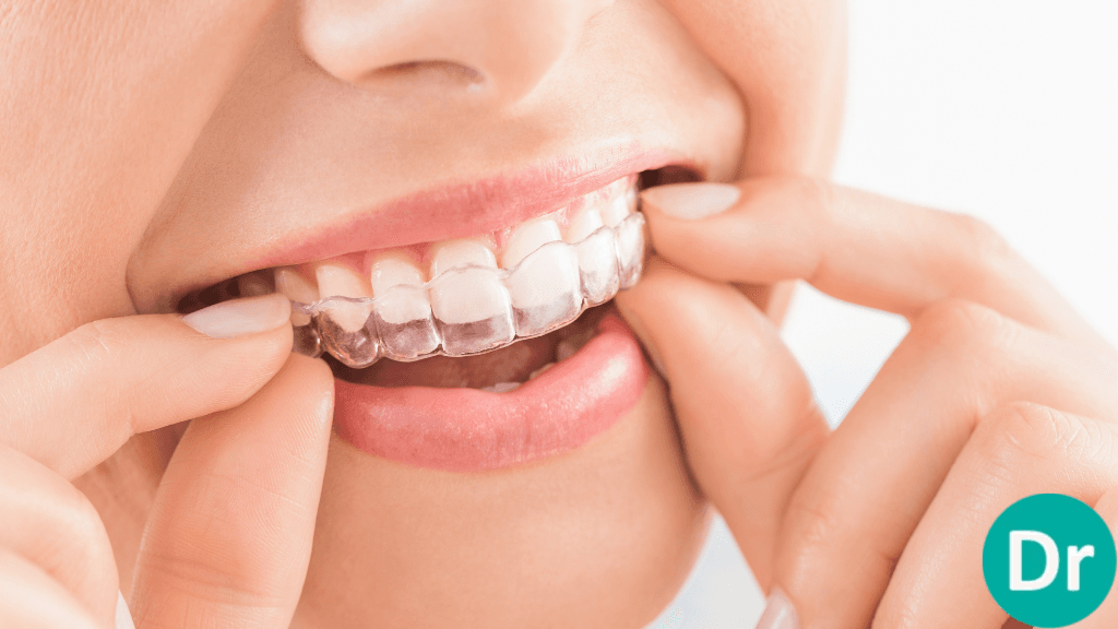 Mouth guard for teeth grinding nhs