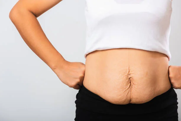 Close up of woman with mummy tummy post pregnancy