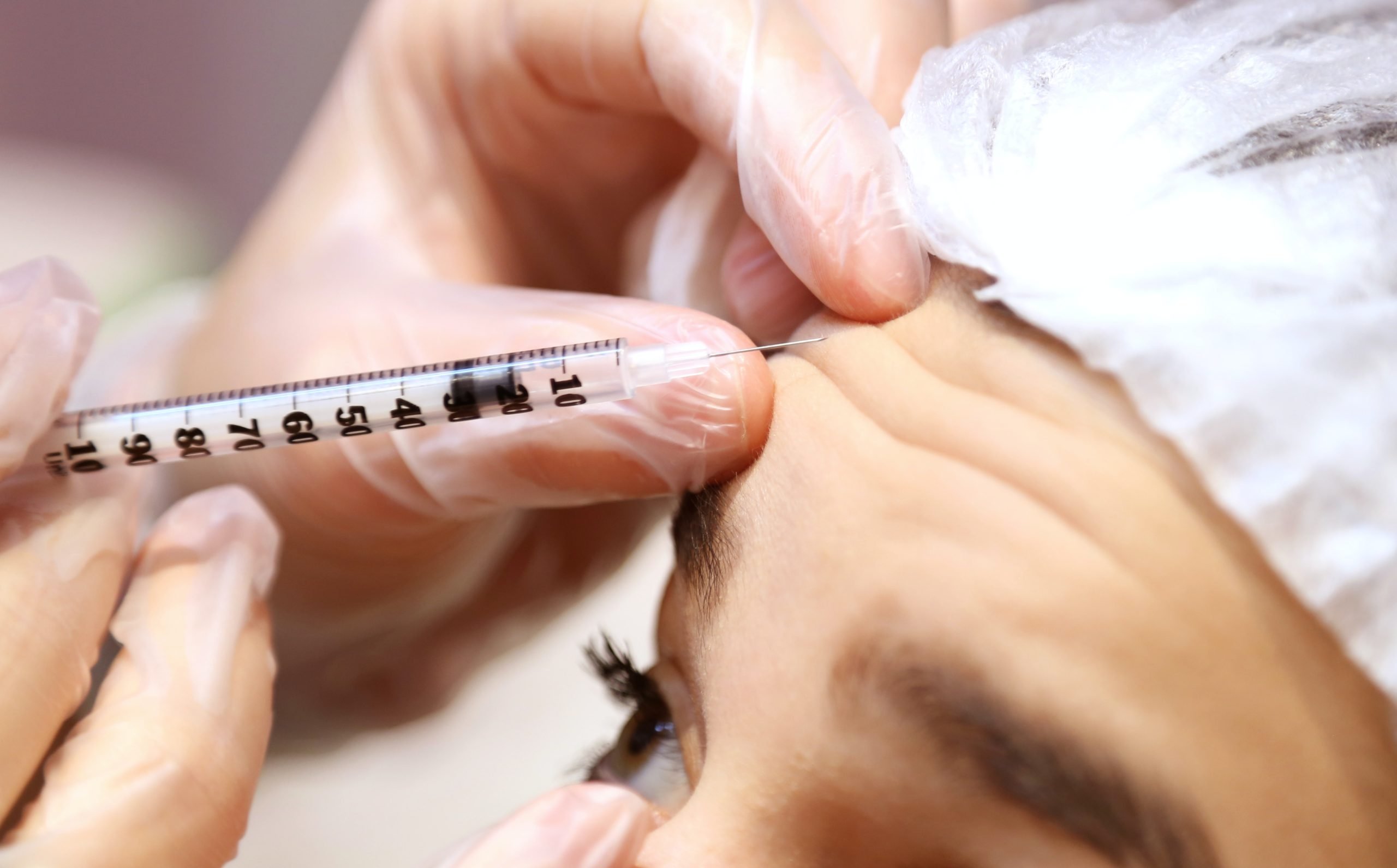 Comprehensive Guide to Botox Treatments – The True Facts & Benefits 