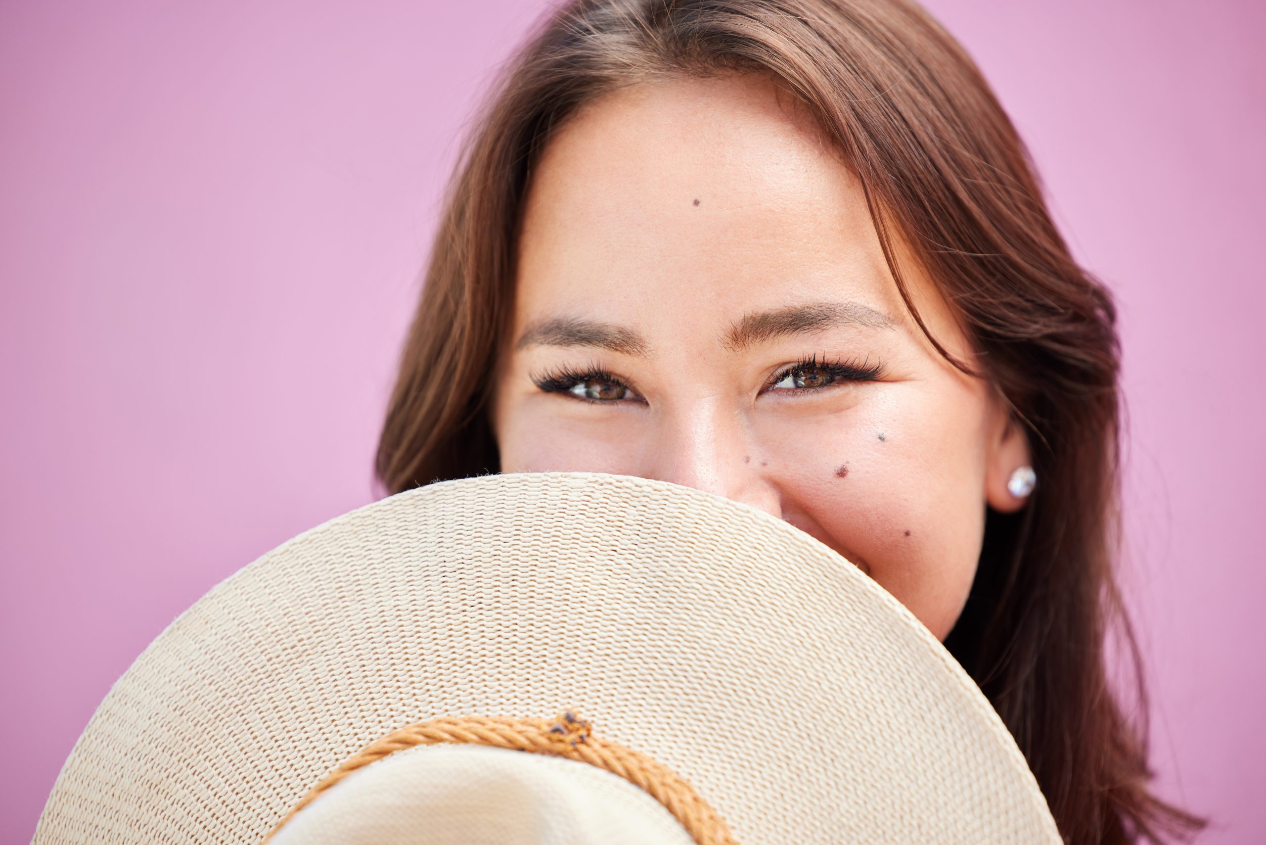Combating Summer Acne: Effective Skincare Solutions