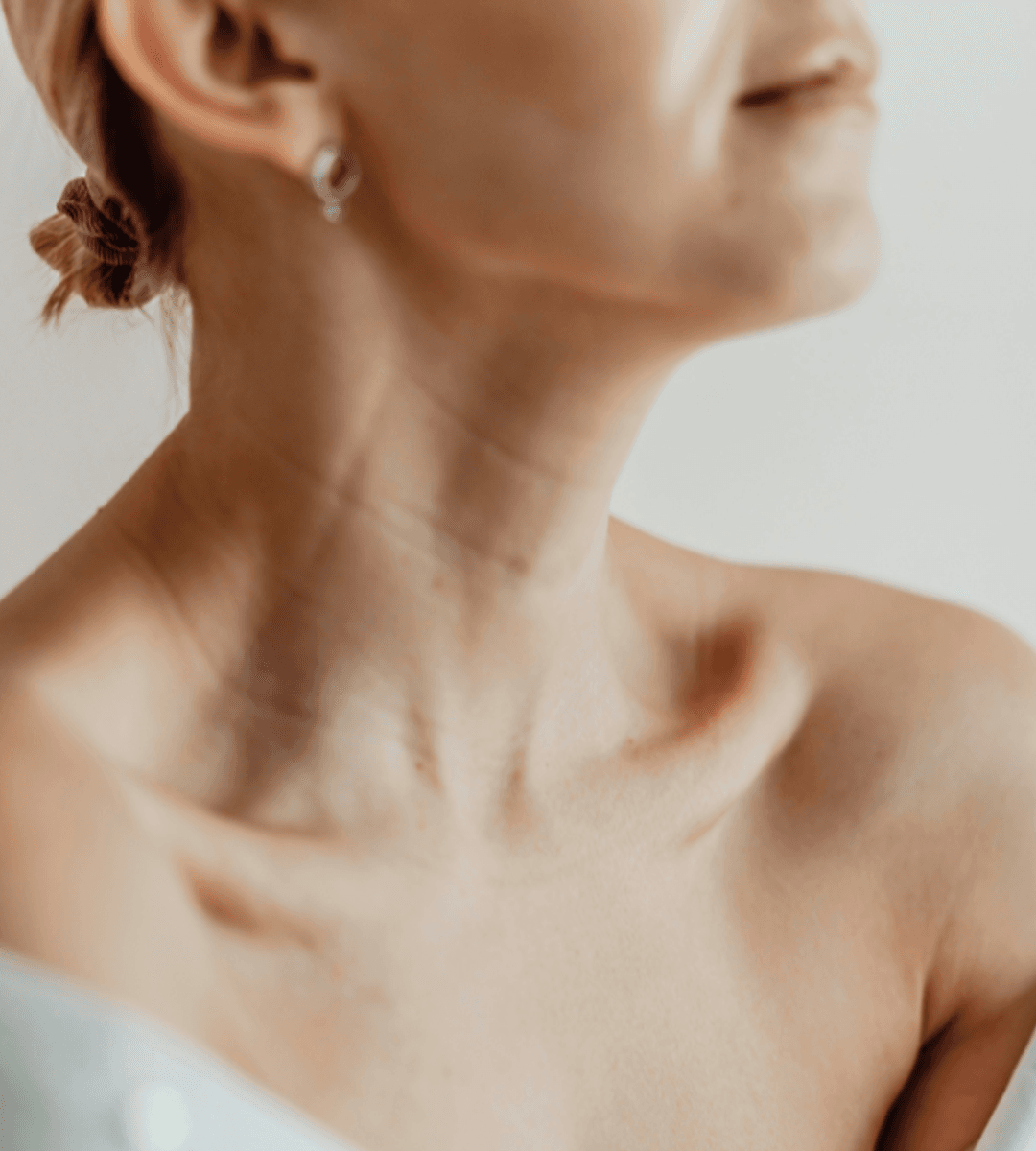 dr-aesthetica-treatment-neck