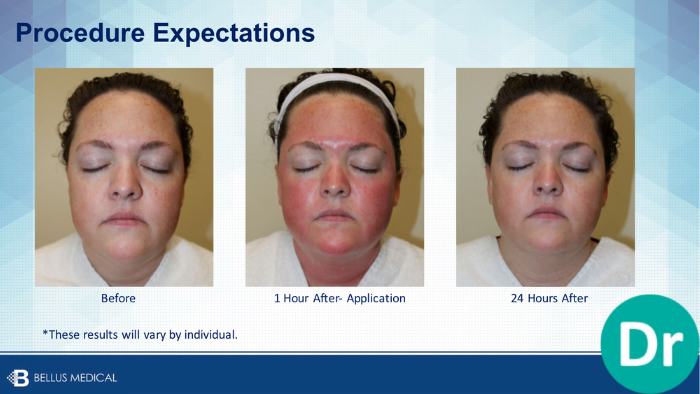 Dr. Aesthetica Before and After Expectations