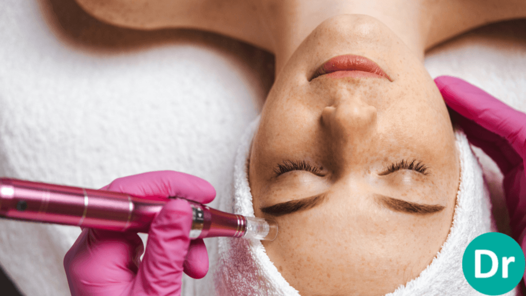 Microneedling outcomes