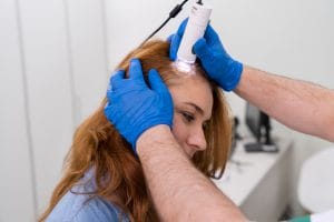 hair loss treatment